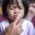 Bệnh chân tay miệng ở trẻ em: Triệu chứng, phòng ngừa và điều trị