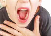 Bệnh viêm họng hạt là gì và cách chữa trị hiệu quả