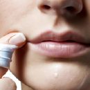 Zovirax – Tất cả những gì bạn cần biết về thuốc chống vi-rút Zovirax